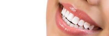 Woman Smiling | Cosmetic Dentist Fort Collins