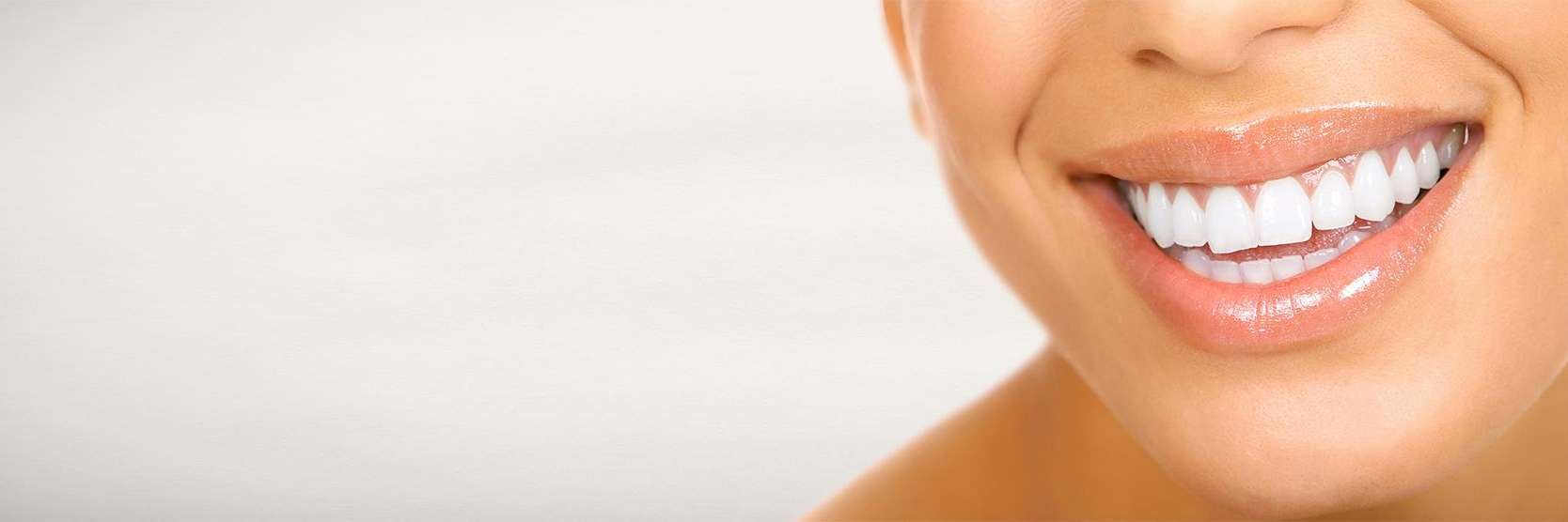 Smiling woman with crowns | Ryan Rush DDS