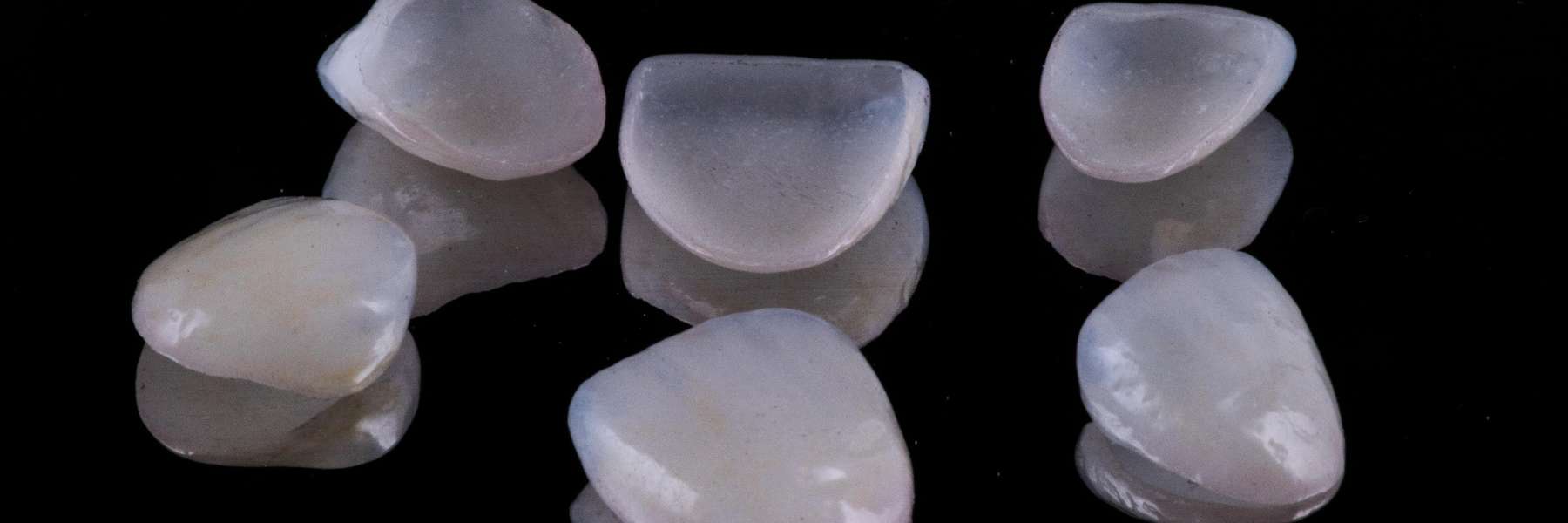 Dental veneers fort collins